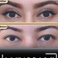 کاشت مو و ابرو / بوتاکس / چربی ژل /کلینیک /زیبایی|خدمات آرایشگری و زیبایی|بوکان, |دیوار