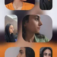 عمل زیبایی بینی در مازندران|خدمات آرایشگری و زیبایی|قائمشهر, |دیوار