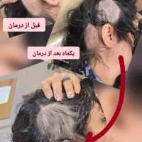 مرکز زیبایی لیزا|خدمات آرایشگری و زیبایی|کرج, شهرک اوج|دیوار