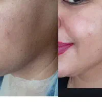 فیشیال تخصصی