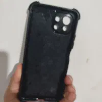 گارد گوشی شیائومی mi 11 لایت