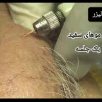 لیزرمو خانم300آقا600ریموتتوخال ژل بوتاکس لک پوستی|خدمات آرایشگری و زیبایی|نجف‌آباد, ویلاشهر|دیوار