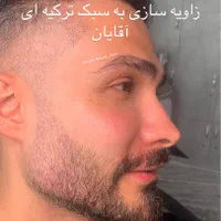 تزریق ژل زاویه فیلر3900نورامیس بوتاکس 390لیزر پزشک