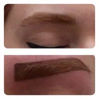 تتوی صورت وبدن باقیمت استثنایی دربندرانزلی