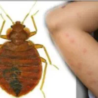 سمپاشی حشرات ساس سوسک موریانه کنه سم پاشی ضمانتی|خدمات نظافت|مشهد, طلاب|دیوار