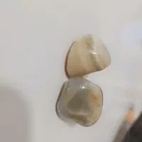 مهره سلمانی