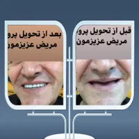 دندانسازی ساخت دندان مصنوعی|خدمات آرایشگری و زیبایی|خرمآباد, |دیوار