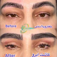 عمل پلک لیفت ابرو سانترال لب تخفیف ویژه|خدمات آرایشگری و زیبایی|تهران, باغ فیض|دیوار