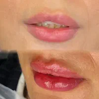 مانکن جهت تزریق لب و کانتورینگ صورت وتزریق چربی|خدمات آرایشگری و زیبایی|تهران, امانیه|دیوار