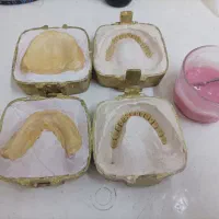 لابراتوار دندانسازی، دندان مصنوعی|آرایشی، بهداشتی، درمانی|تبریز, |دیوار