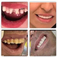 کلینیک دندانپزشکی ترمیمی زیبایی|خدمات زیبایی و سلامت|تهران, ونک|دیوار