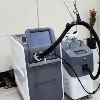 فروش دستگاه لیزر کندلا