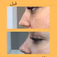 خدمات زیبایی در کلینیک ماهورا