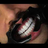 دندانپزشکی زیبایی جشنواره 50 درصدی با ضمانت|خدمات آرایشگری و زیبایی|تهران, نیاوران|دیوار