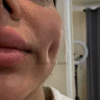 اموزش/اجراپیرسینگ ومیکرودرمال‌ ونگین دندان وچال لپ|خدمات آرایشگری و زیبایی|رشت, استادسرا|دیوار