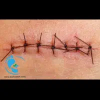 خدمات پرستاری منزل،تزریقات،سرم تراپی پانسمان حجامت|خدمات آرایشگری و زیبایی|چناران, |دیوار