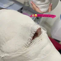 پاکسازی پوست تخصصی درمان پوست فیشال|خدمات آرایشگری و زیبایی|مشهد, توس (بلوار توس)|دیوار