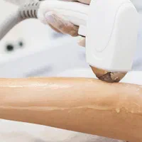 لیزر موهای زائد فقط در ۴جلسه تضمینی تا پایان مرداد|خدمات آرایشگری و زیبایی|ایلام, |دیوار