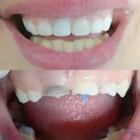 خدمات زیبایی دندان