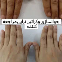 پدیکوریست خاص/ترک/پینه/قوزک|خدمات آرایشگری و زیبایی|قم, تولید دارو و یخچال|دیوار