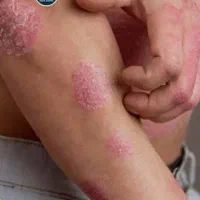 خداحافظی با زخم های بدنت