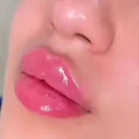 ژل فیلر|خدمات آرایشگری و زیبایی|خرمآباد, |دیوار