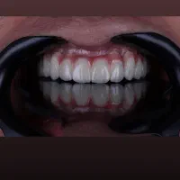 دستیار دندانپزشک