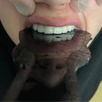 دندان سازی|خدمات آرایشگری و زیبایی|خوی, |دیوار