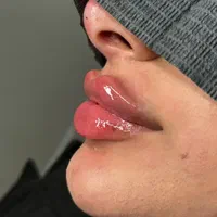 جشنواره بوتاکس فول فیس زاویه سازی ژل لب گونه چانه|خدمات آرایشگری و زیبایی|مشهد, فرهنگ|دیوار
