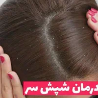 شپ ش و رشک