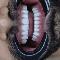 استخدام دندانپزشک درمانی و زیبایی
