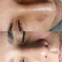 فیشال تخصصی/پلاژن تراپی/کربوکسی /پارافین تراپی|خدمات آرایشگری و زیبایی|کرمان, |دیوار