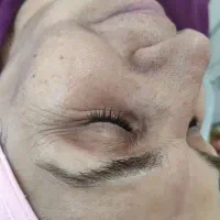 تخفیف پاکسازی پوست فیشال احیا مو لیفت ابرو