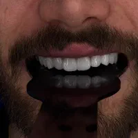 دندانپزشکی روکش  دیجیتال و کامپوزیت