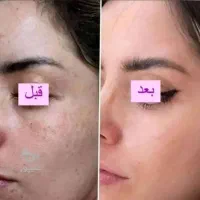 کرم وی آی پی اصل|آرایشی، بهداشتی، درمانی|امیدیه, |دیوار