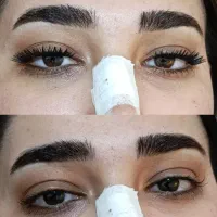 کاشت هیدن