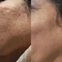 محصولات تراست