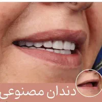 دندانسازی سازنده دندان مصنوعی باضمانت