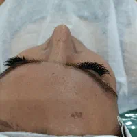 فیشال و پاکسازی|خدمات آرایشگری و زیبایی|خرمآباد, |دیوار