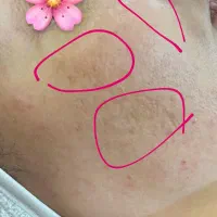 فشیال و اسکراب اسکالپ بطور تخصصی|خدمات آرایشگری و زیبایی|سبزوار, کاشفی شمالی (دادگستری)|دیوار