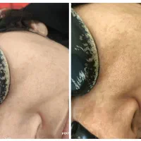 خدمات تاتو، کربن تراپی|خدمات آرایشگری و زیبایی|ساوه, |دیوار