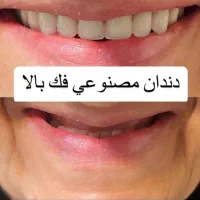 دندانساری متحرک(مصنوعی)|خدمات آرایشگری و زیبایی|اصفهان, جاوان|دیوار