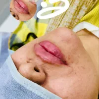 جشنواره آف ژل و بوتاکس|خدمات آرایشگری و زیبایی|شیراز, خلدبرین|دیوار
