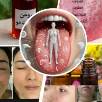 درمان بیماریها با طب سنتی