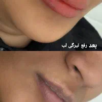 آموزش میکروبلیدینگ و آرایش دائم|خدمات آموزشی|جیرفت, |دیوار