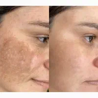 کرم ملکه صد درصد تضمینی تضمینی