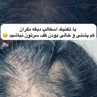 مدل برای موهای کم پشت خانم تکنیک میکرو اسکالپ|خدمات آرایشگری و زیبایی|لاهیجان, قیام|دیوار