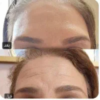 اموزش پلکسر