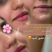 جشنواره تخفیفات تابستانه کلینیک رویال|خدمات آرایشگری و زیبایی|قدس, شهر‌قدس|دیوار