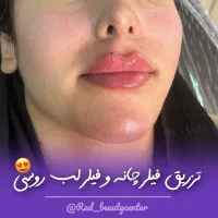 خدمات تخصصی زیبایی و مراقبت پوست و مو کلینیک راد|خدمات آرایشگری و زیبایی|تهران, صادقیه|دیوار